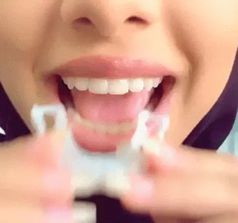 woman trying Snap-On Smile